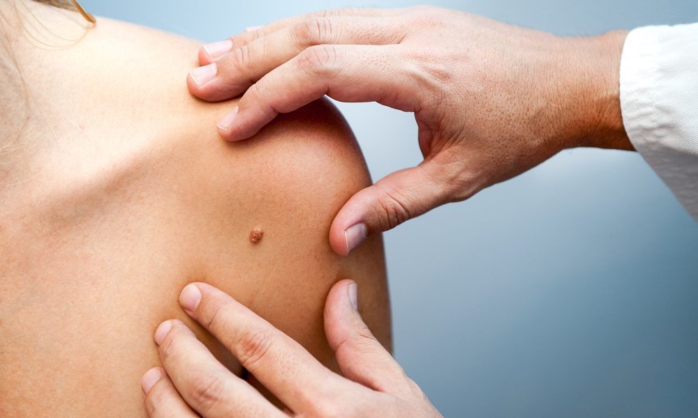 Endocrinologia Ciampino Ciampino Aeroporto | Clinica Sanatrix