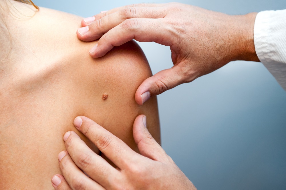 Dermatologia Roma Nomentano | Clinica Sanatrix